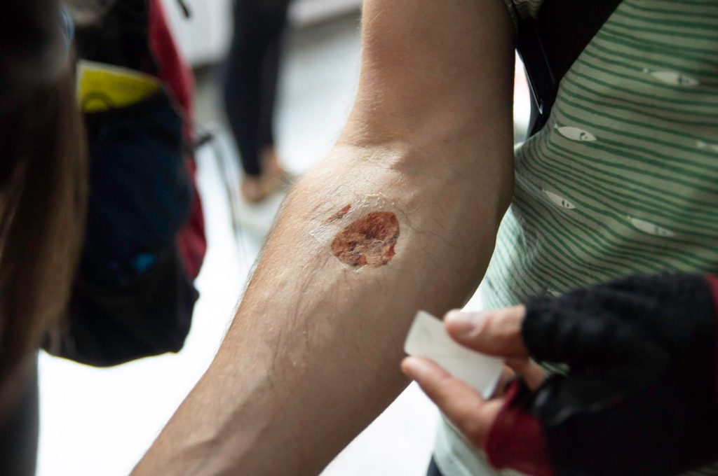 This is supposed to be a mineral- even though it looks a bit like a scab at 1st glance.